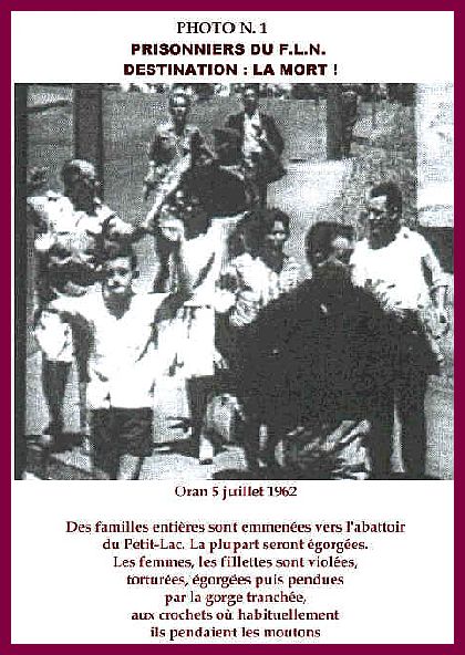 Normal 1er au bled (5 juillet 1962 à Oran, un massacre oublié) - Une alternative dans l'information